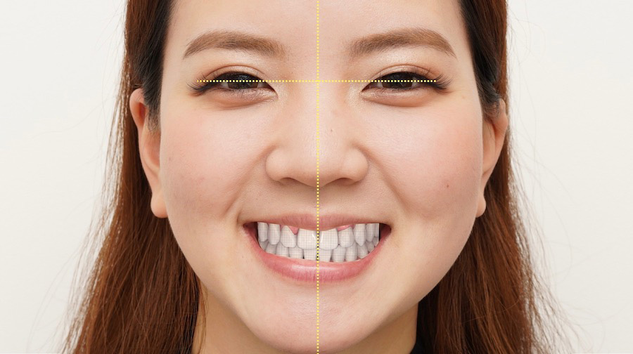 お顔と歯並びを総合的にデジタルで診断します。