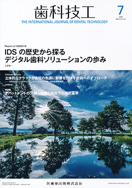 「インプラントを埋入した後で全顎的矯正治療を行なった咬合再構成(アナログ編)」