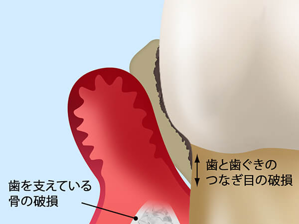 健康なお口を維持するための根本的な治療を