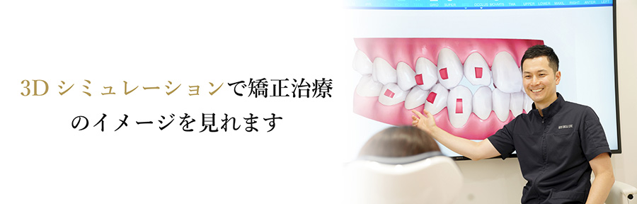 時代はワイヤー矯正からマウスピース矯正へ