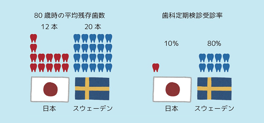 メインテナンスで歯を残しましょう