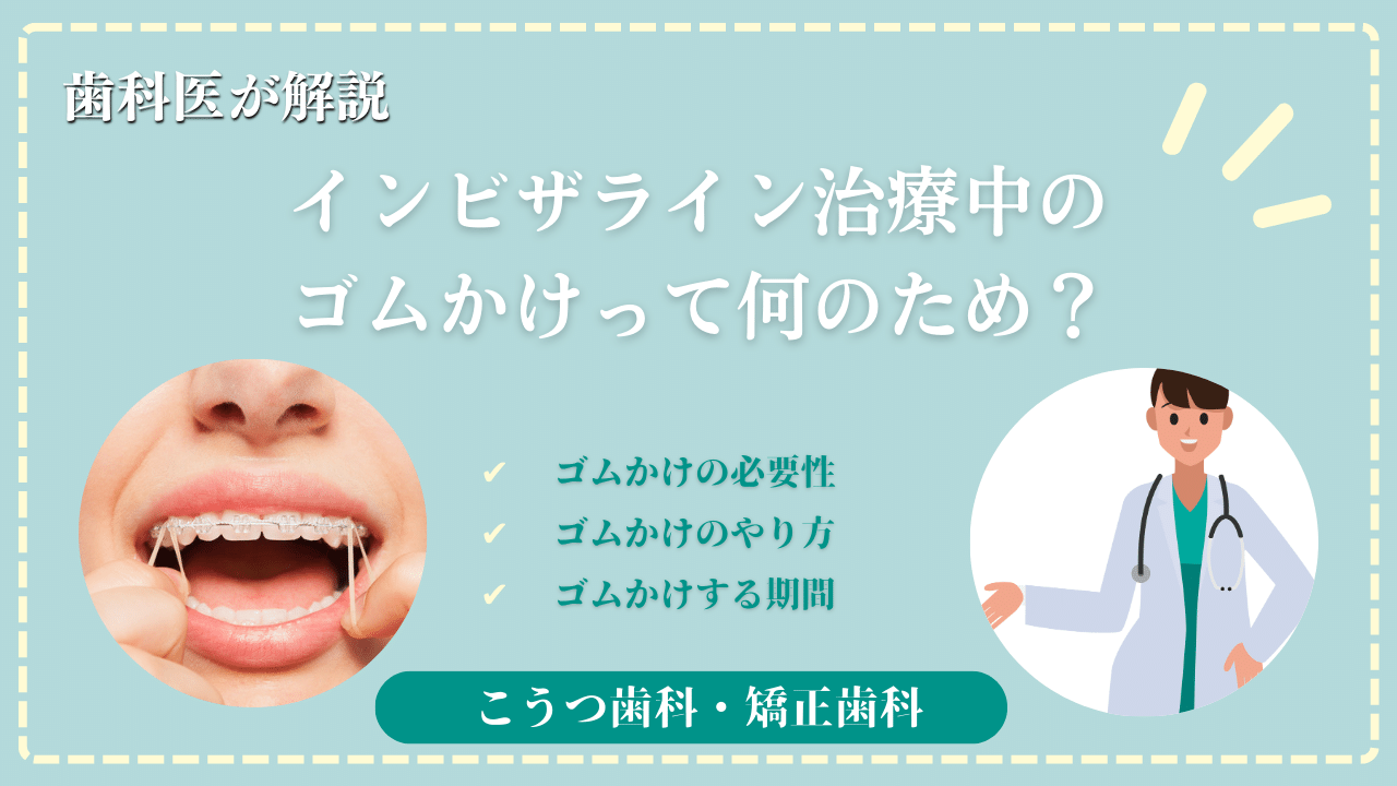 インビザラインのゴムかけとは？役割やタイミング、注意点について