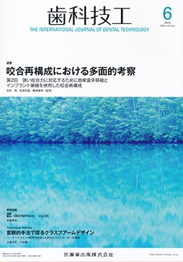 「強い咬合力に対応するために自家歯牙移植とインプラント 補綴を併用した咬合再構成」