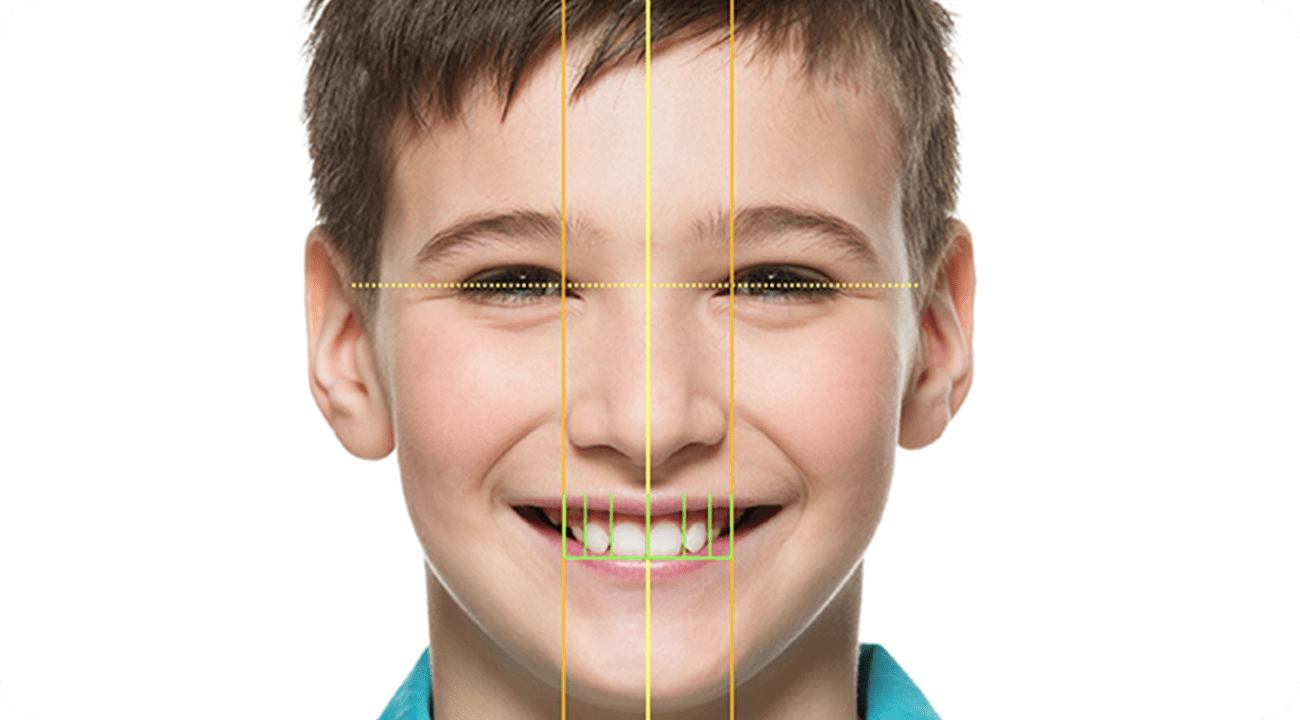 お顔と歯並びを総合的にデジタルで診断